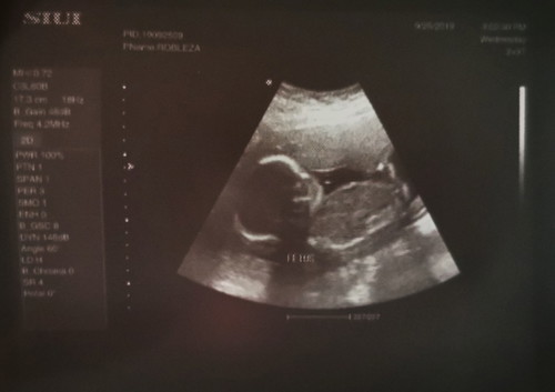 my little one ❤️