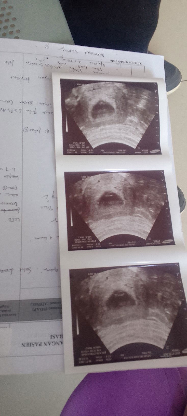 Erna ER profile icon