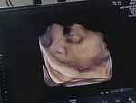 Patharawadee profile icon