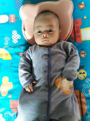 น้อง2เดือนไม่ถ่าย