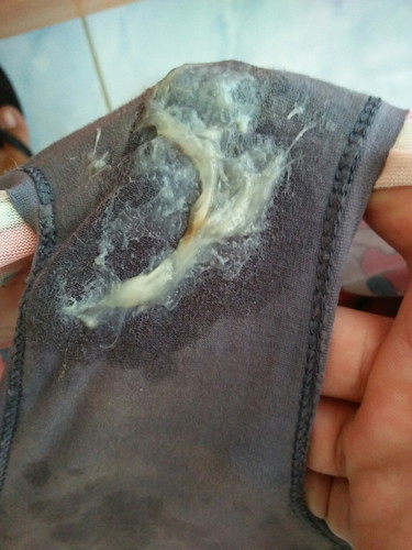 mucos plug