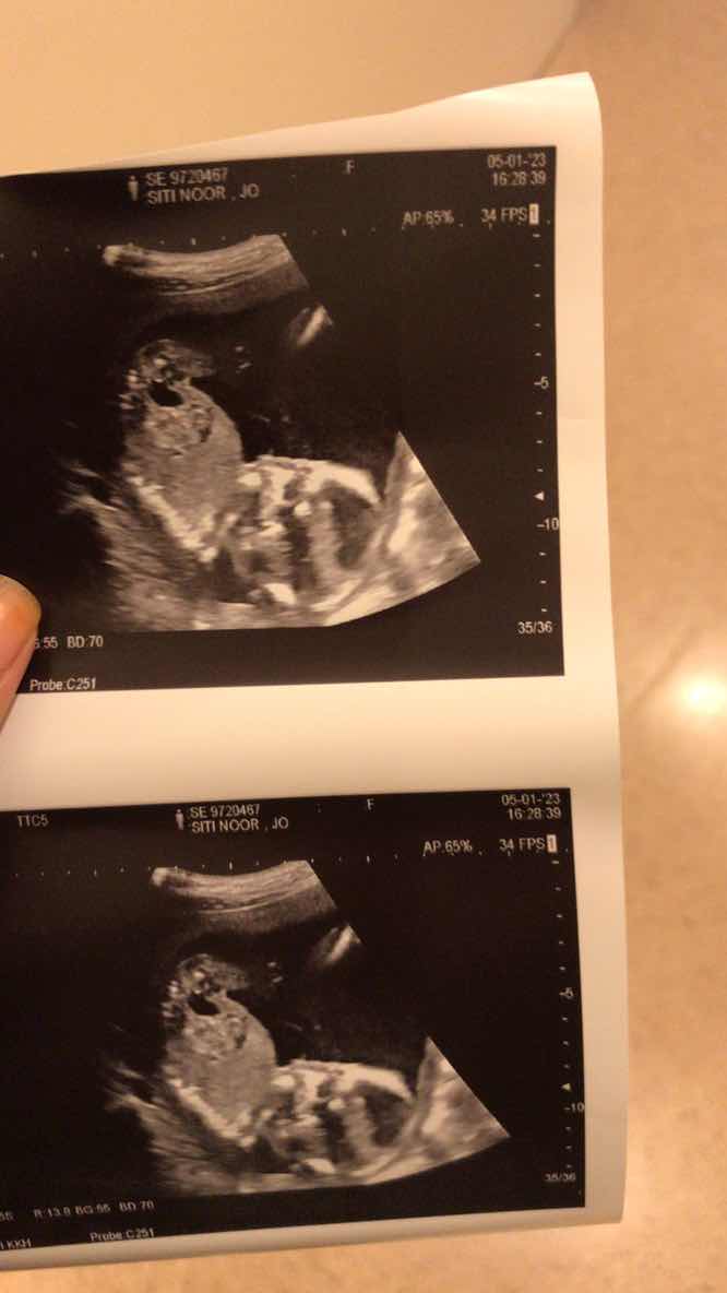 mommies rse gurl ke boy