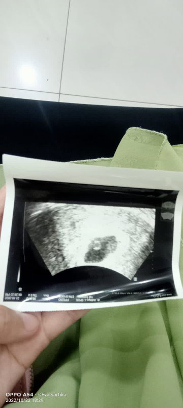 Eva sartika profile icon