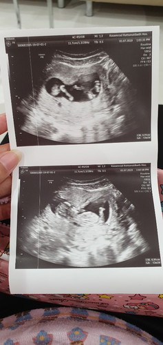 3 เดือนกับอีก 8 วันค่ะ