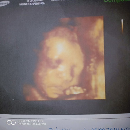 bé nhà nhà mình dc 30W r nặng 1450g là nhỏ hay bình thường ạ