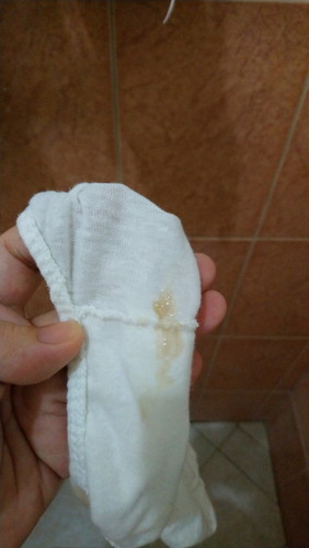 Mucus Plug?
