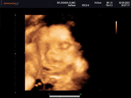 Yasmine Vallin profile icon