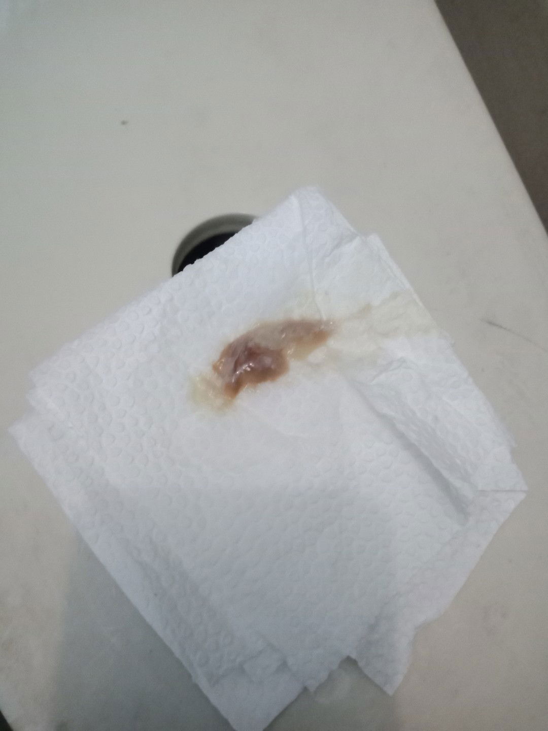Mucus Plug?