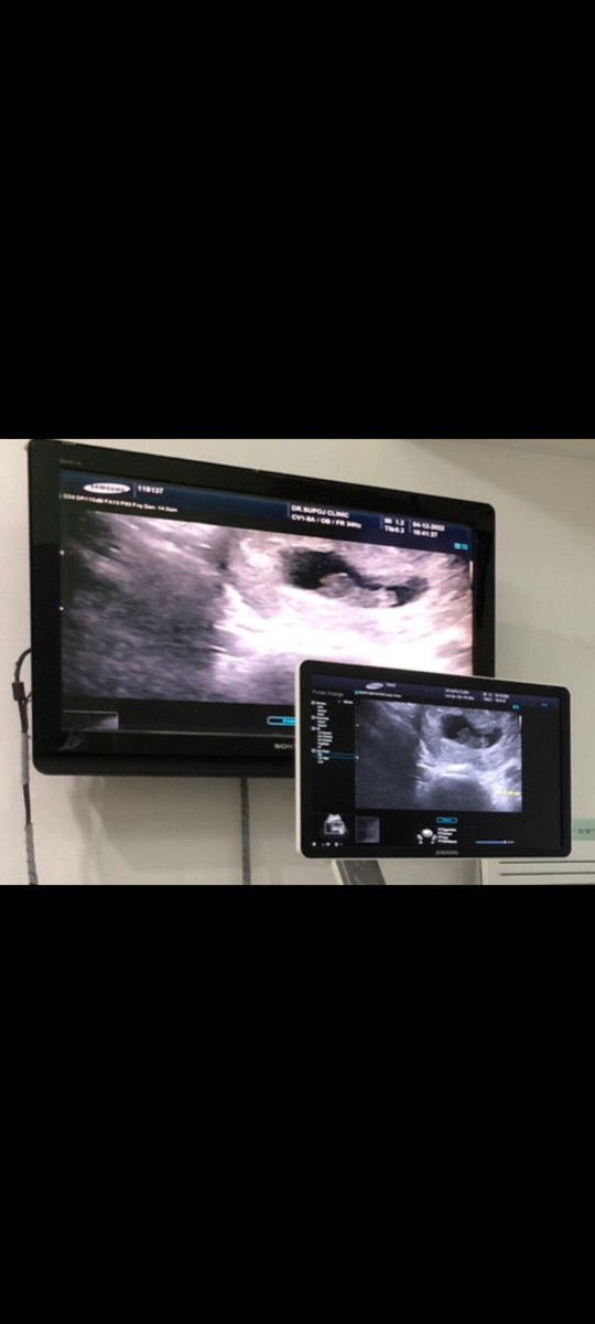 My baby profile icon