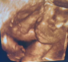 Iris Johan profile icon