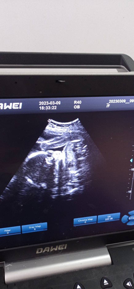 ไมล่า profile icon