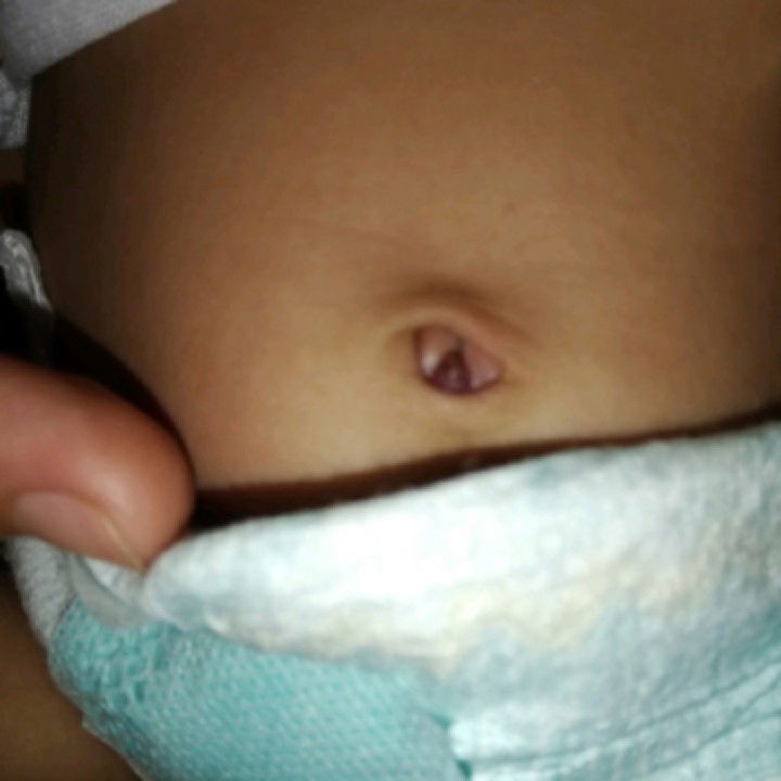 pusod ni baby
