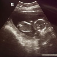 Mamy Antha profile icon