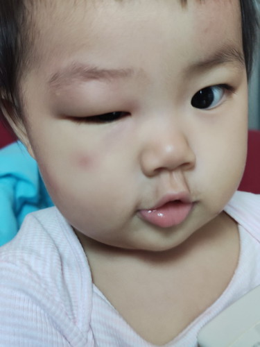 ไม่รู้น้องโดนอะไร