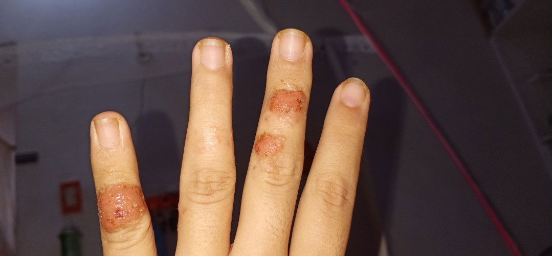 skin Problem?Allergy?