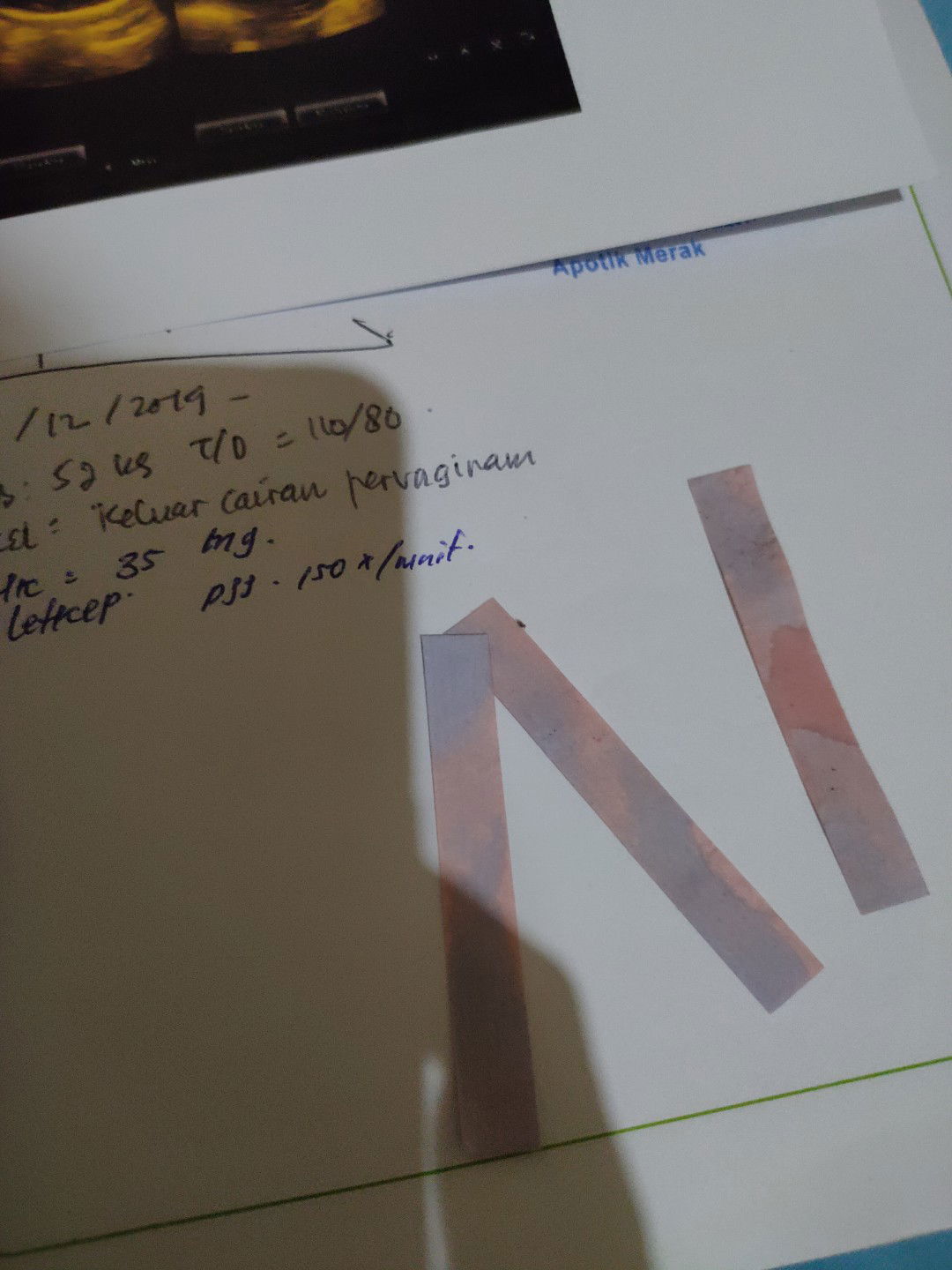 lakmus ( ketuban rembes)