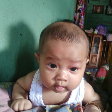 mata bengkak
