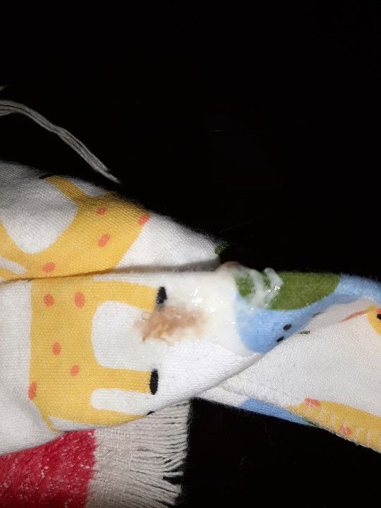 Kulay brown sa lungad