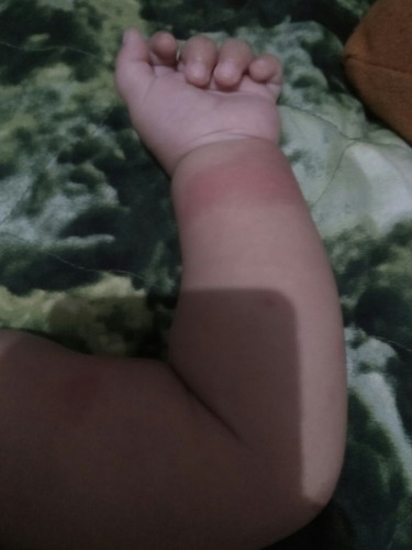 bintik merah