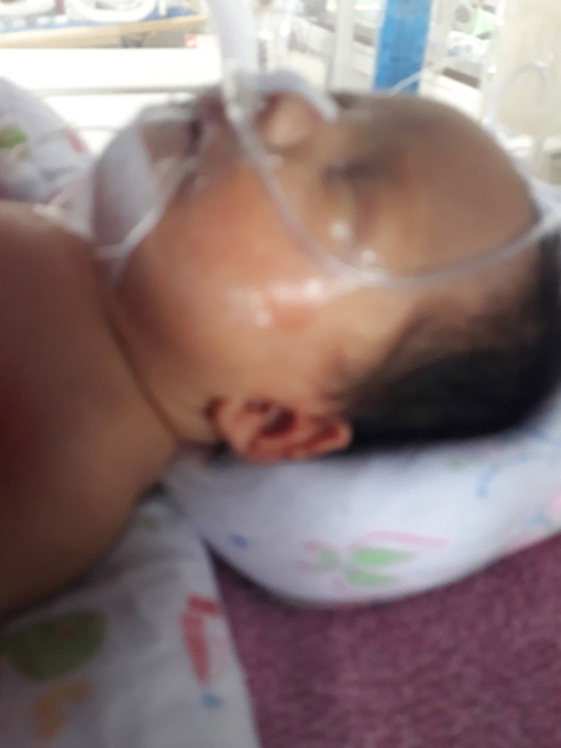 อัพเดทกรณีคลอดตอน 34 W