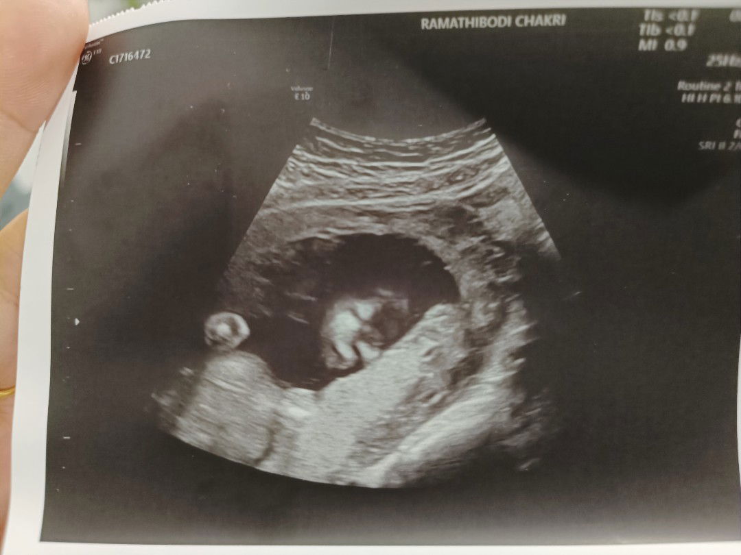 aoyleen profile icon