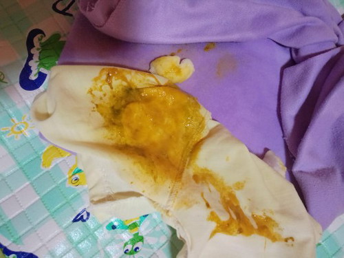 Pup bayi encer sehari pup 3 kali usia bayi 6 bulan