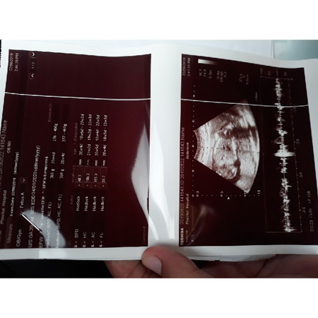 ตอนไปซาวอายุครรภ์16วีค