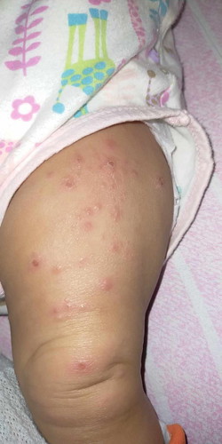 Mga mii ano kaya ito? 6months palang si baby