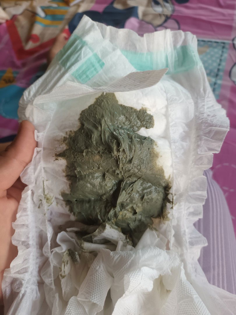 สอบถามแม่ๆอึลูกสีนี้ปกติมั้ยคะ