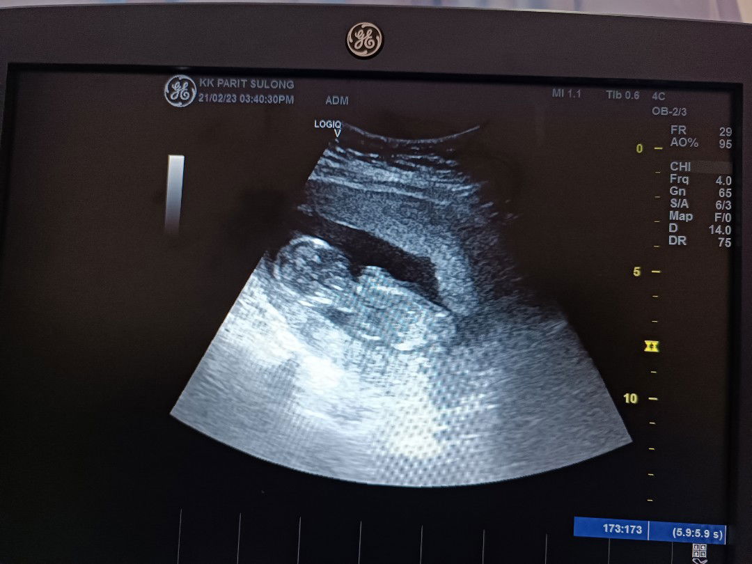 Siti Hajar binti Rahmat profile icon