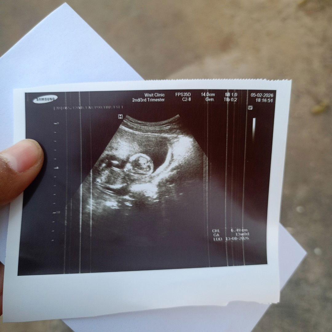 หญิงหรือชายคะแม่ๆแบบนี้