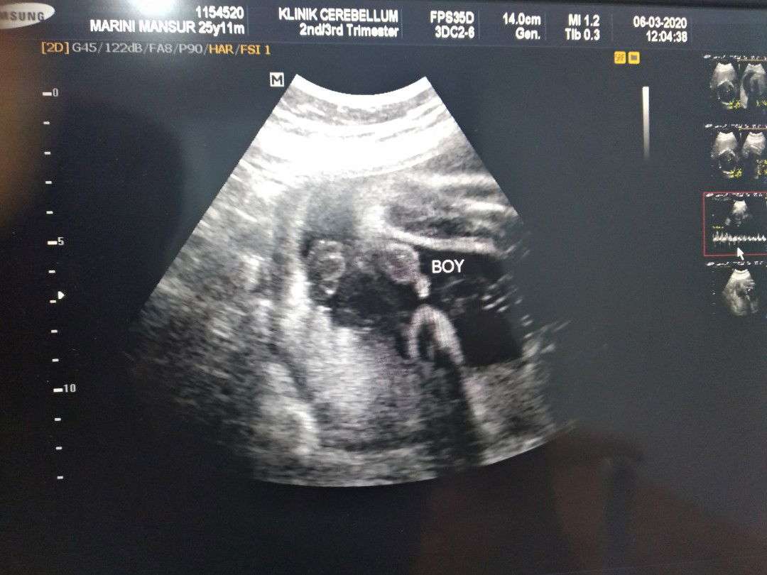 Ummu Khalil profile icon