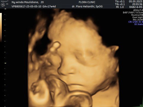 Queen Raden profile icon