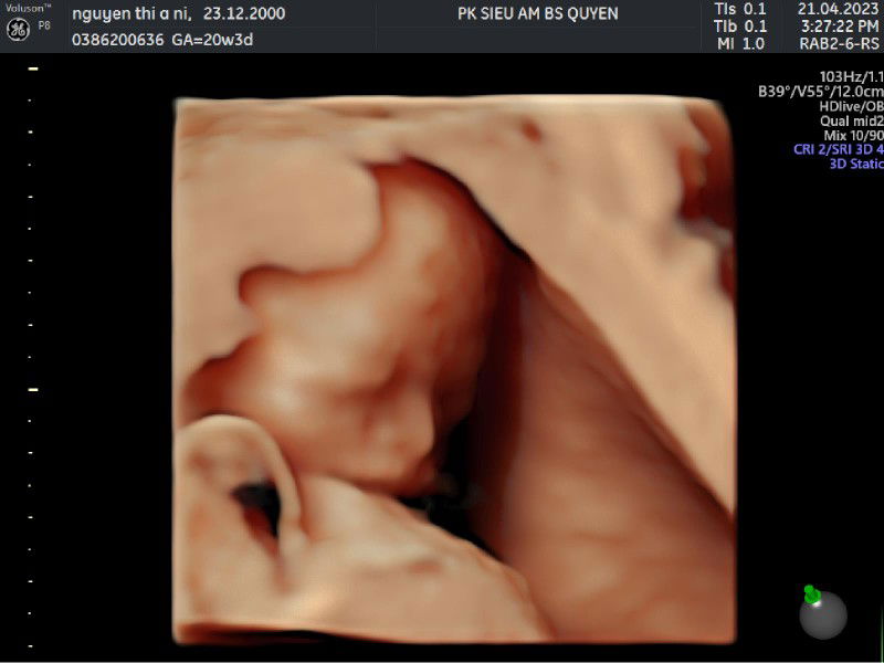 Ani Nguyễn profile icon