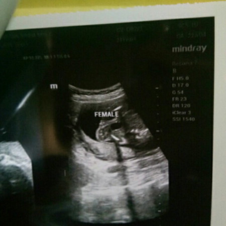 Baby gender at five months