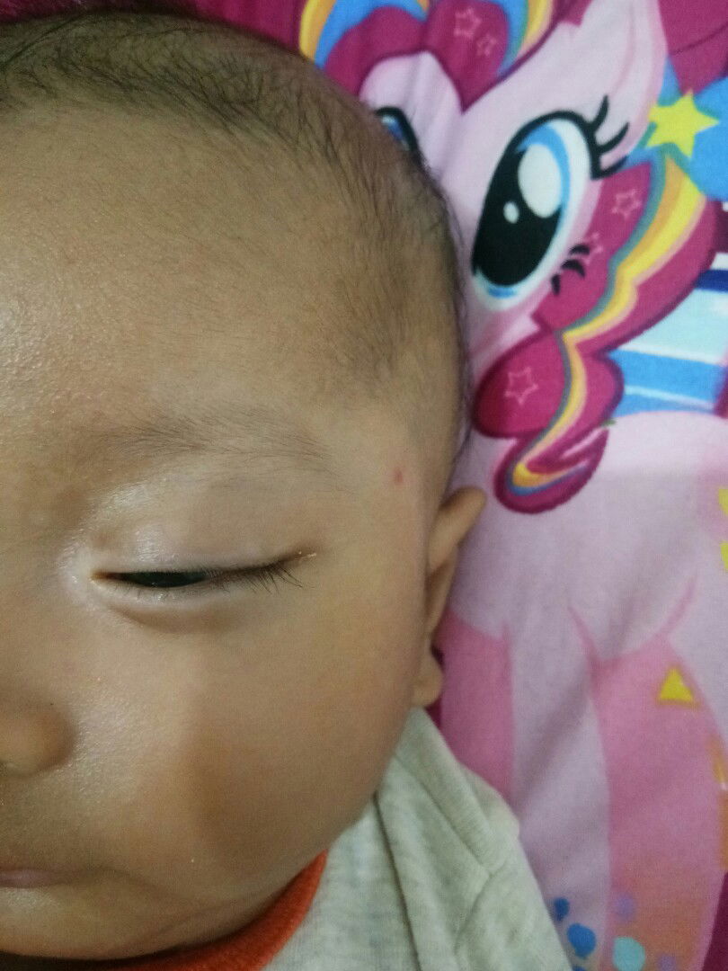 mata bayi pinggiran putih