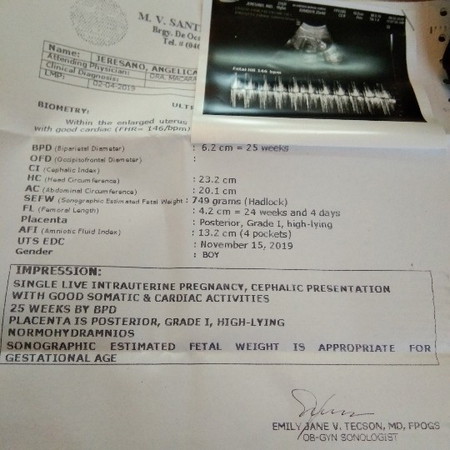 Ultrasound