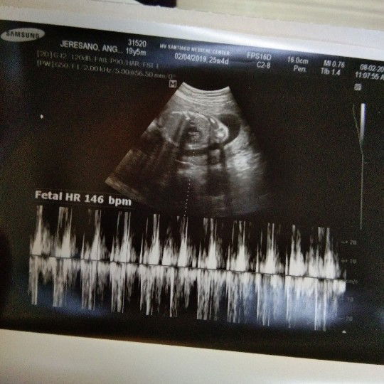 Proud Soon to be mom! ❤