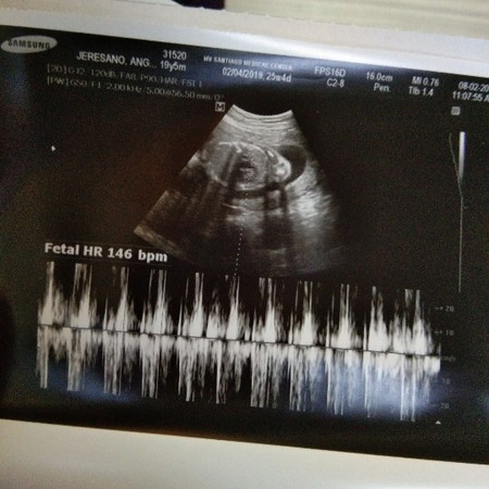 Proud Soon to be mom! ❤