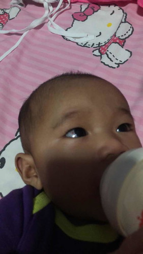 เลือดในตา