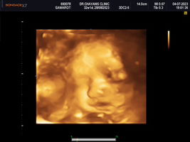 สวรส สิทธิศักดิ์สกุล profile icon