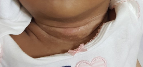 Rashes