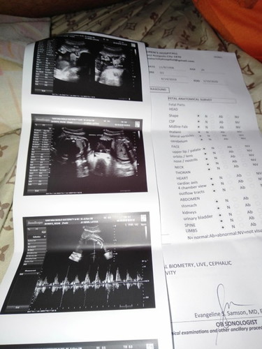 CAS ULTRASOUND RESULT
