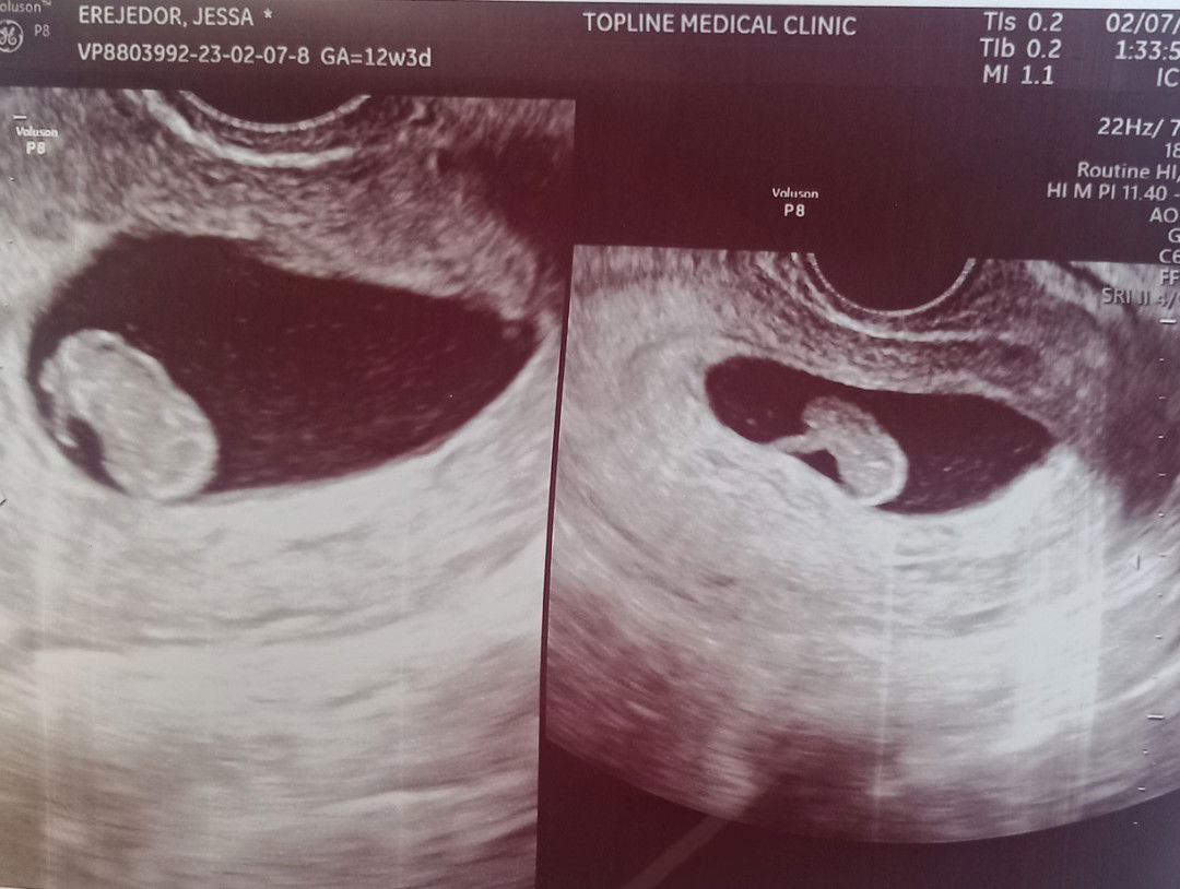 Jessa Erejedor profile icon