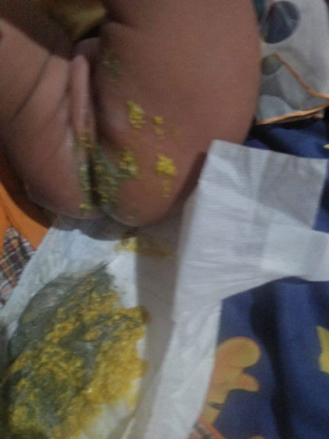 bab Hitam kadang kehijauan