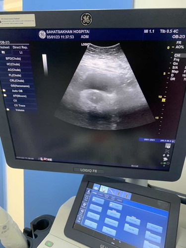 ไปฝากครรภ์พึ่งมาค่ะ บ้านนี้5W จ้า