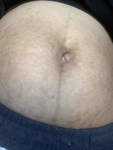 ทีมสิงหาคลอดแล้ว