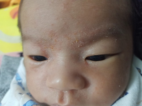น้องแพ้อะไรหรือเปล่า?