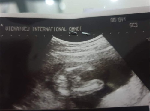 ช่วยดูเพศน้องหน่อยค่ะ ชายหรือหญิงค่ะ