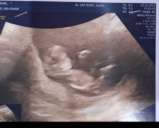 NUR WIWI ANITA DAELI profile icon